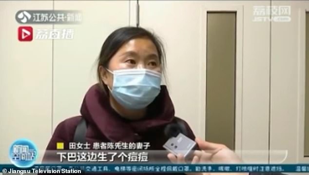 Трикутник смерті: у Китаї чоловік ледь не помер через прищ на обличчі - фото 2