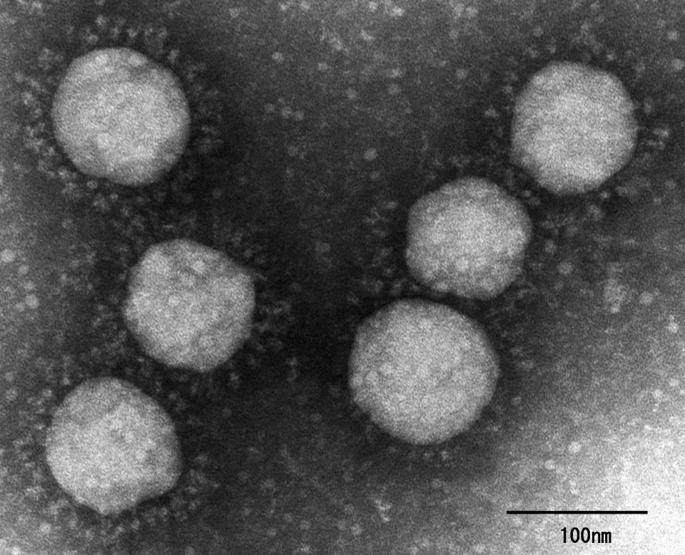 В Японії виявили новий штам коронавірусу: чим він примітний - фото 2
