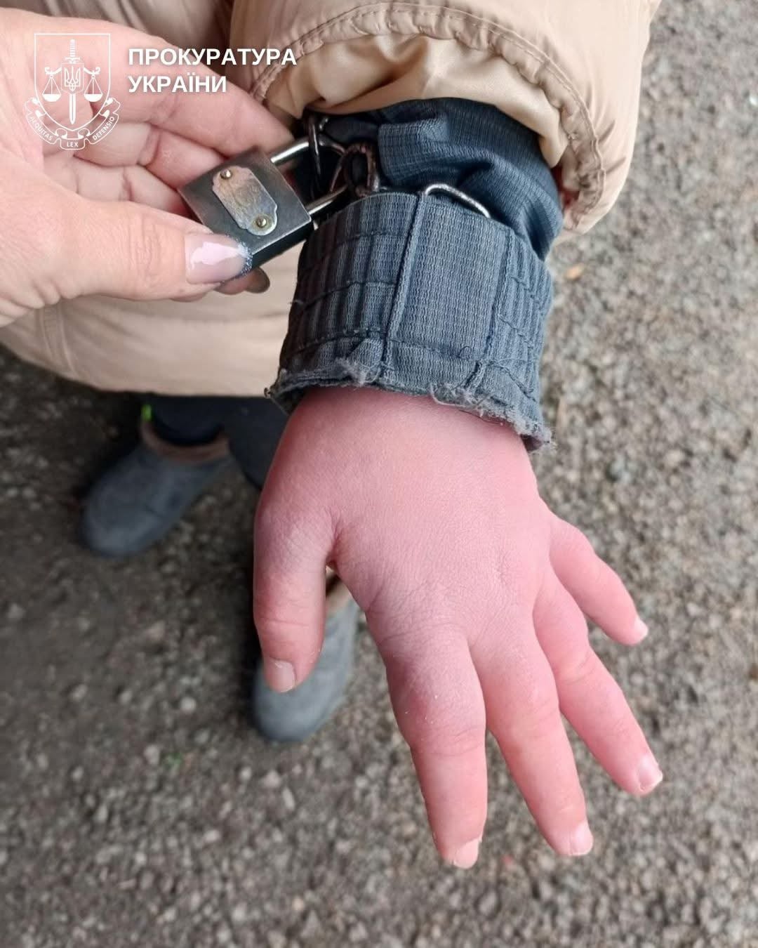 Скандал у дитбудинку: дівчинку з інвалідністю тримали на ланцюгу  - фото 2