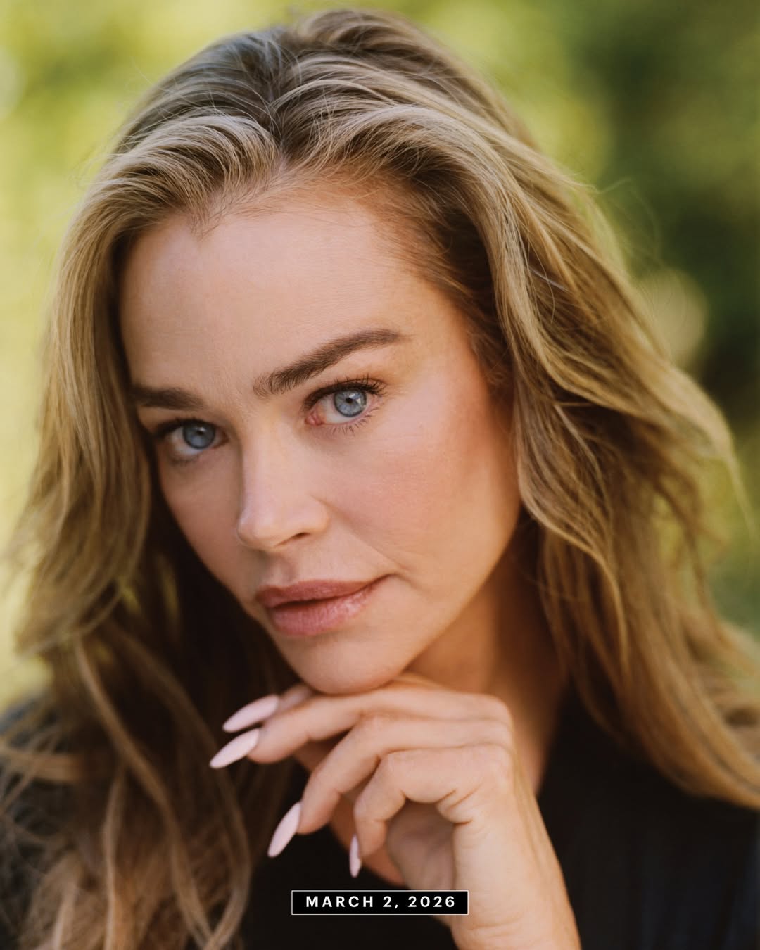 Девушка Бонда Дениз Ричардс сделала пластическую операцию и показала фото до и после - фото 2