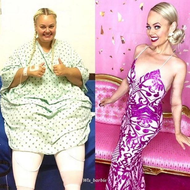 Женщина похудела на 90 килограмм, чтобы ”стать” Барби (ФОТО) - фото 3