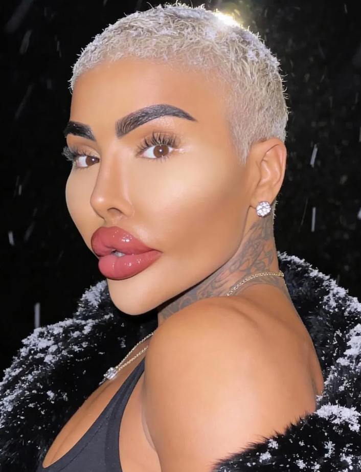 ”Король губ” з Британії помер під час пластичної операції (ФОТО) - фото 2 ”Король губ” з Британії помер під час пластичної операції (ФОТО) - фото 2