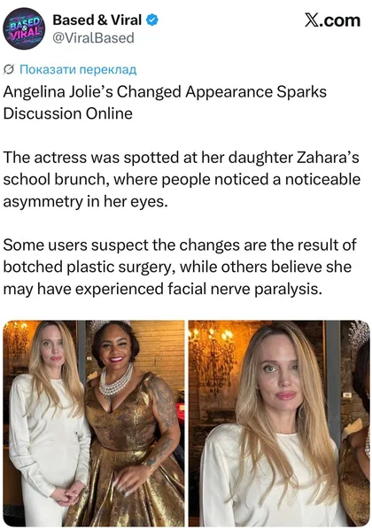 Анджелина Джоли испугала поклонников: с актрисой, что-то не так (ФОТО) - фото 2