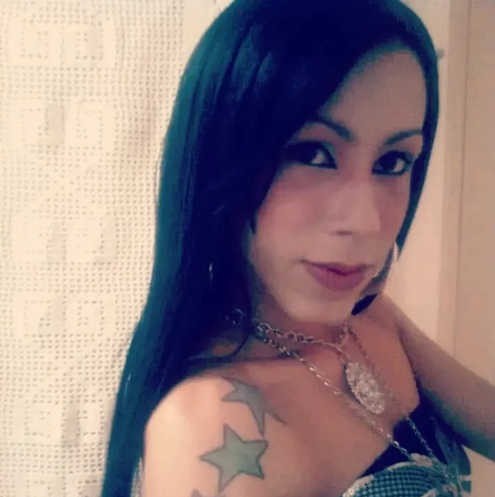 Інфлюенсерка хотіла змінити обличчя: косметична процедура перетворила її життя на жах (ФОТО) - фото 2