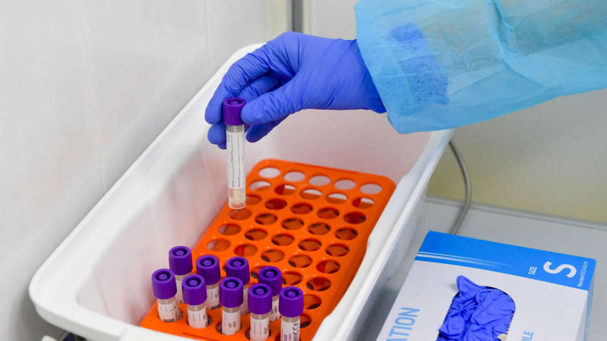 Правительство планирует закупить 20 тысяч тест-систем у отечественных производителей — замглавы Минздрава