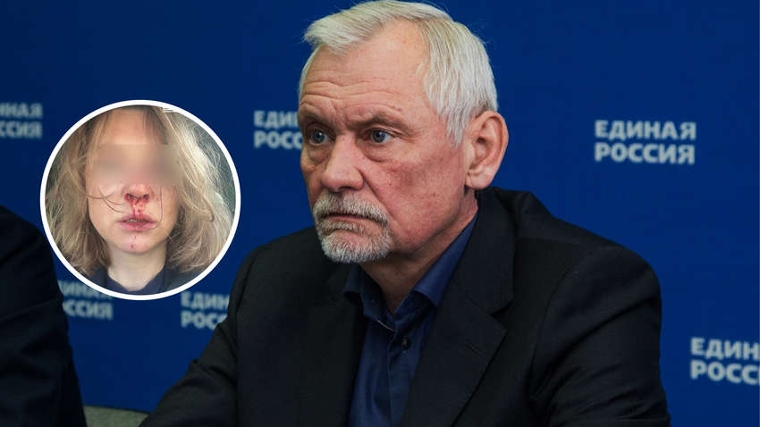 Російський депутат Держдуми побив колишню дружину Російський депутат Держдуми побив колишню дружину