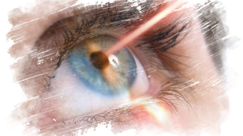 Лікар пояснила, коли краще робити лазерну корекцію зору