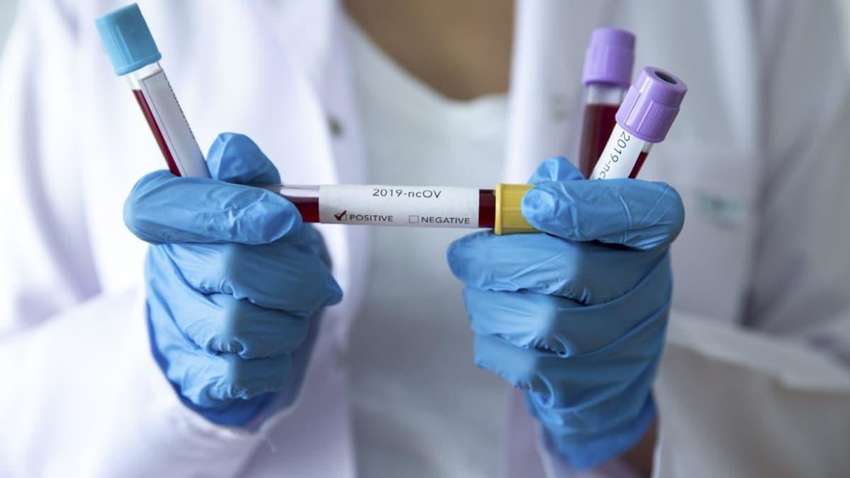 Число випадків зараження коронавірусом COVID-19 у всьому світі перевищили 4 мільйони