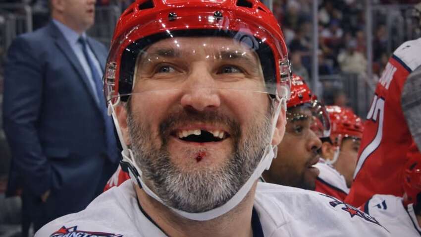 Российскому хоккеисту Овечкину выбили зуб во время хоккейного матча НХЛ (ВИДЕО)