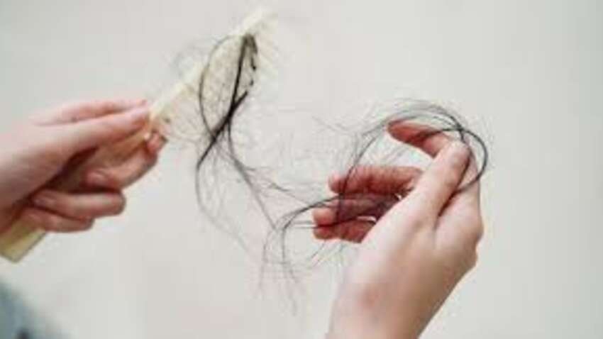 Волосы сыплются зимой горстями: почему в январе проблема накрывает даже здоровых людей Волосы сыплются зимой горстями: почему в январе проблема накрывает даже здоровых людей