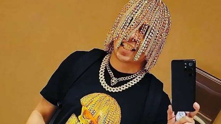 23-летний рэпер вместо волос вживил в голову золотые украшения (ФОТО) 23-летний рэпер вместо волос вживил в голову золотые украшения (ФОТО)