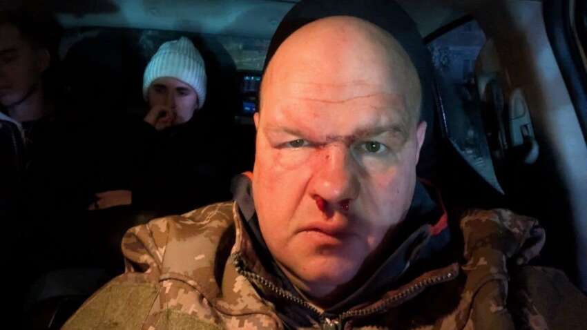 Скандал у Кременці: мажори на квадроциклах побили майора ЗСУ після ДТП й намагалися «вирішити питання» через ТЦК Скандал у Кременці: мажори на квадроциклах побили майора ЗСУ після ДТП й намагалися «вирішити питання» через ТЦК