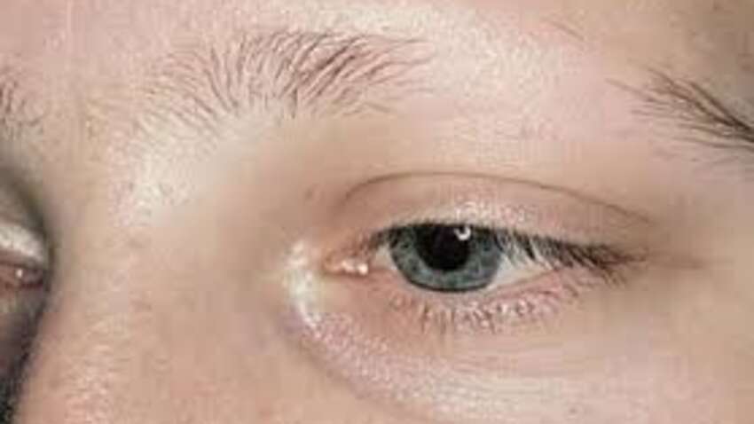 В России у женщин массово выпадают брови В России у женщин массово выпадают брови