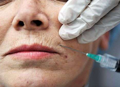 В США пластического хирурга из Одессы судят за халатность