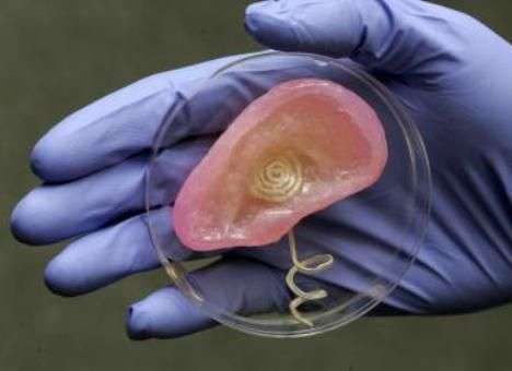 На 3D-принтере напечатали бионическое ухо