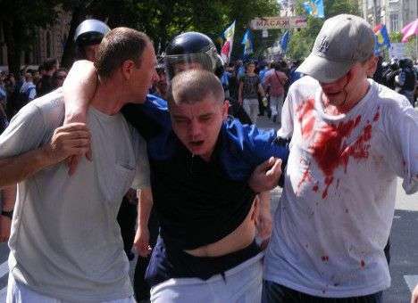 В драке в центре Киева пролилась кровь (ФОТО)