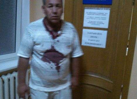 Председатель Алуштинского меджлиса битой пробил голову конкуренту