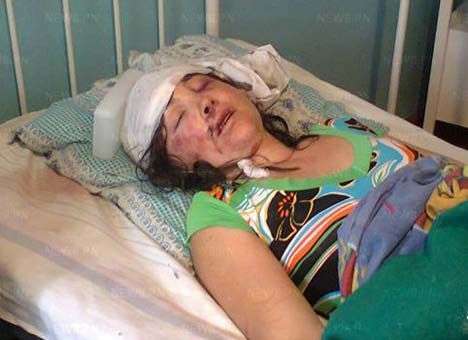 В МВД пытались спрятать изнасилование во Врадиевке - Москаль