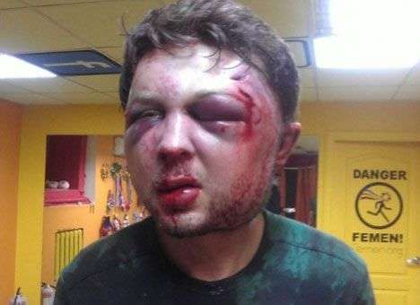 В Киеве до неузнаваемости избили мужчину-политолога FEMEN (ФОТО)