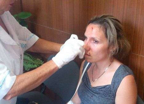 В Крыму депутат избил семейную пару в своем кабинете - СМИ (ФОТО, ВИДЕО)