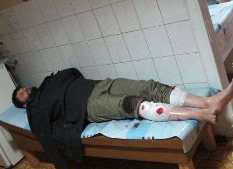 В Ивано-Франковске ночью избили лидера местного майдана