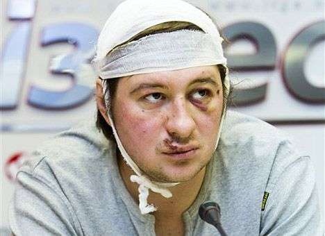 За избиения журналистов на митинге открыто уже 19 уголовных дел