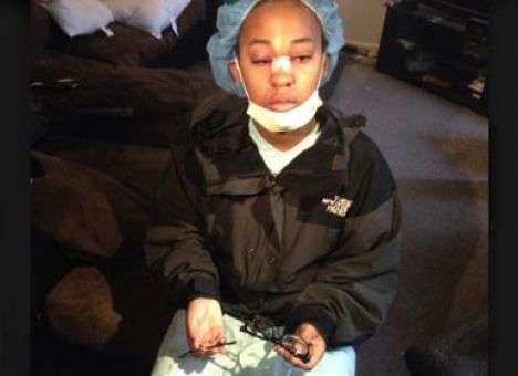 Подросток в США выжил после пули, попавшей в переносицу