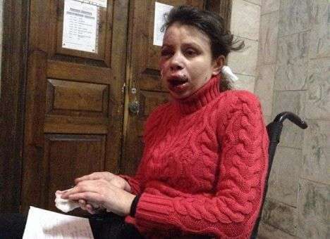 Неизвестные жестоко избили журналистку (ФОТО, ВИДЕО)