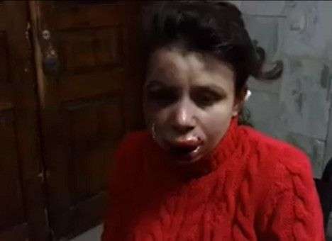 Президент поручил Пшонке и Захарченко расследовать избиение журналистки Черновол