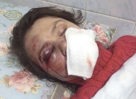 Избиение Черновол потянуло на второе уголовное производство