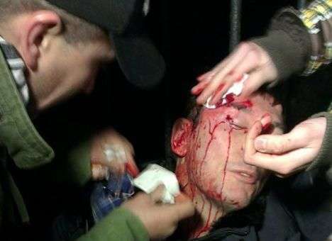 «Беркут» разбил голову Луценко (ВИДЕО)