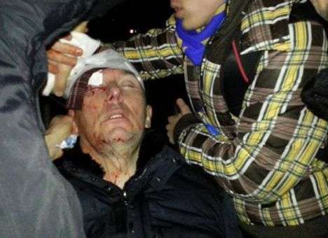 Луценко находится в реанимации после побоев «Беркута»