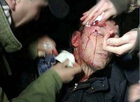 МВД отрицает, что «Беркут» бил Луценко (ВИДЕО)