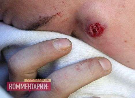 Сегодня в столкновениях в Киеве пострадало около ста человек — Пшонка