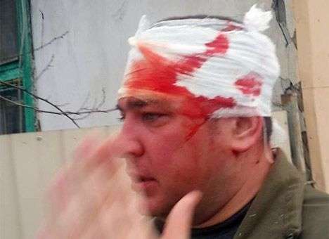 Царев в Одессе устроил кровавое побоище. Есть раненые (ФОТО, ВИДЕО)