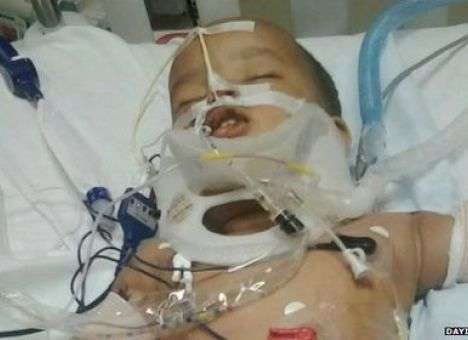 В США годовалый ребенок выжил после падения с 11 этажа