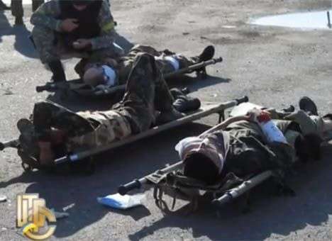 За период АТО был ранен 991 военнослужащий – Минобороны