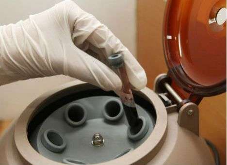 ВИЧ научились выводить из ДНК человека