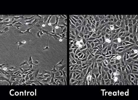 Наночастицы на 50% ускоряют регенерацию тканей (ФОТО)
