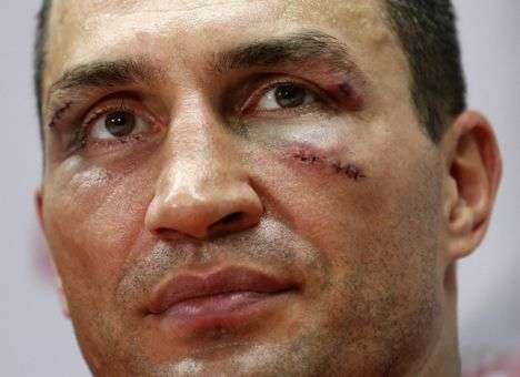 Кличко может сменить тренера после первого поражения за 11 лет