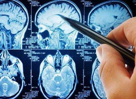 Ученые разработали уникальную диету MIND