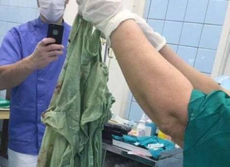 Такое бывает: Российские хирурги оставили в животе пациентки огромную простынь (ФОТО)