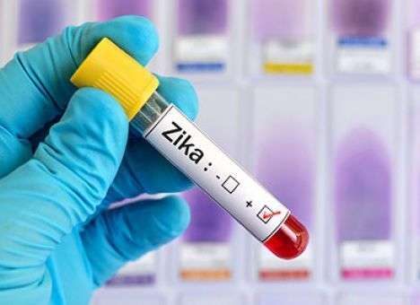 Подтвердились худшие опасения относительно вируса Зика