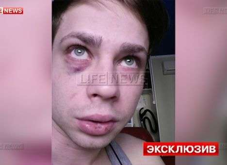 С ноги ударили по лицу: Российского актера жестоко избили по дороге домой
