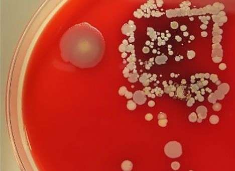 Придуман способ заставить врачей более ответственно относиться к гигиене