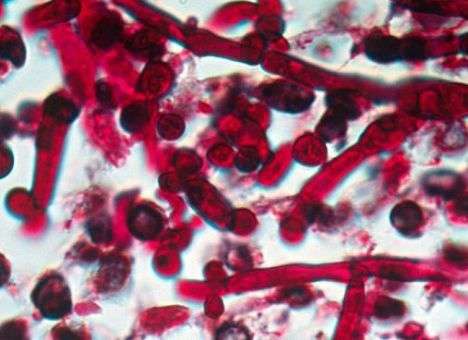 Смертельно опасная грибковая инфекция захватывает нашу планету – предупреждают ученые