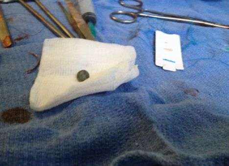 В центре Киева велосипедист получил от водителя пулю (ФОТО)