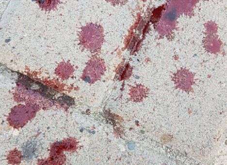 В Киеве на набережной пролилась кровь (ФОТО)