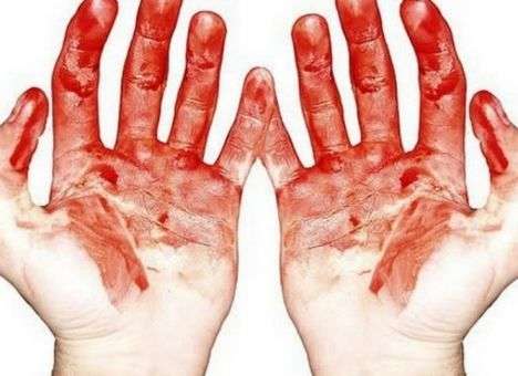 В Киеве за месяц в роддомах умерло две роженицы – источник