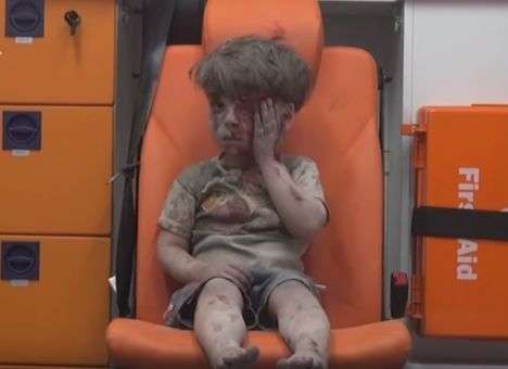 Умер брат мальчика, которого назвали «символом ужаса войны» (ВИДЕО)